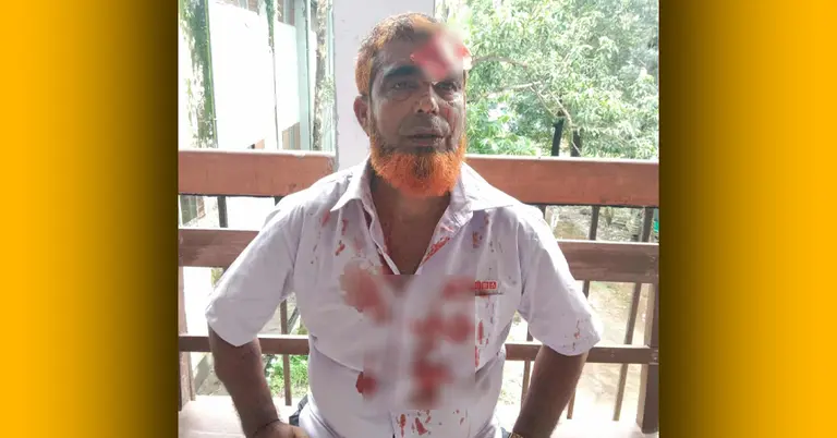 আহত আবদুল মন্নান মৃধা ওরফে চুন্নু